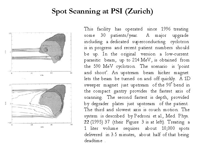Spot Scanning at PSI (Zurich) This facility has operated since 1996 treating some 30