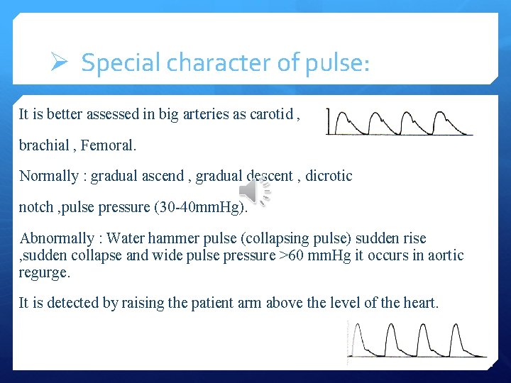 Ø Special character of pulse: It is better assessed in big arteries as carotid