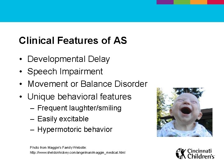 Clinical Features of AS • • Developmental Delay Speech Impairment Movement or Balance Disorder