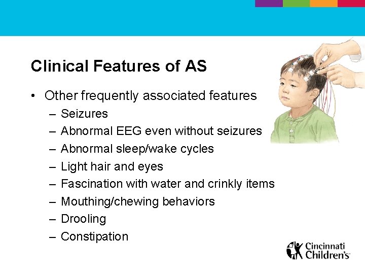 Clinical Features of AS • Other frequently associated features – – – – Seizures
