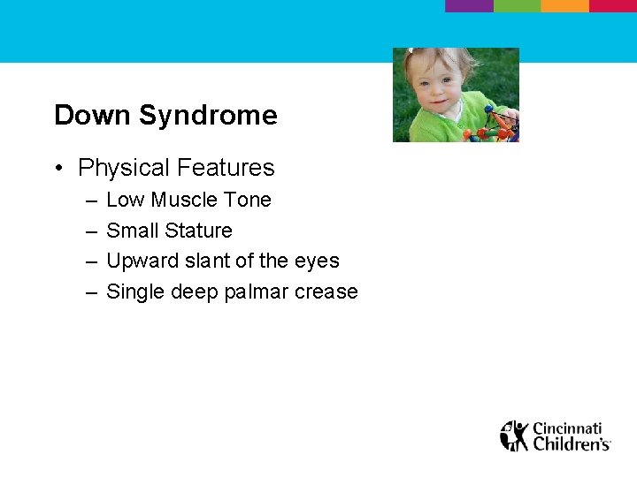Down Syndrome • Physical Features – – Low Muscle Tone Small Stature Upward slant