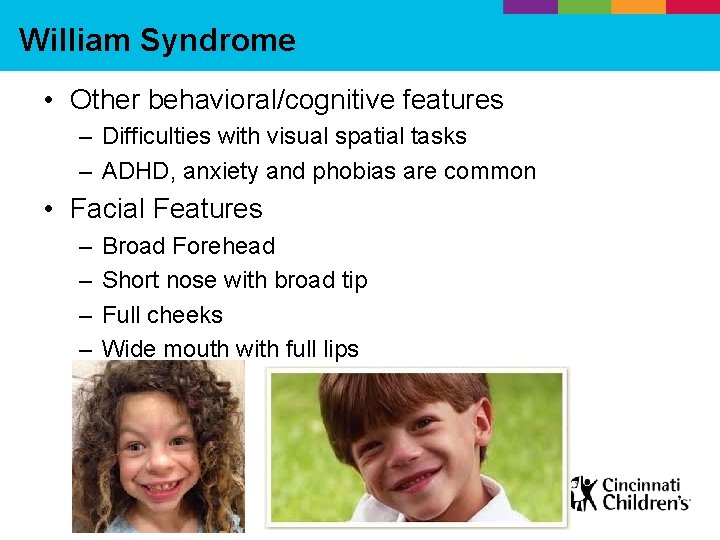 William Syndrome • Other behavioral/cognitive features – Difficulties with visual spatial tasks – ADHD,