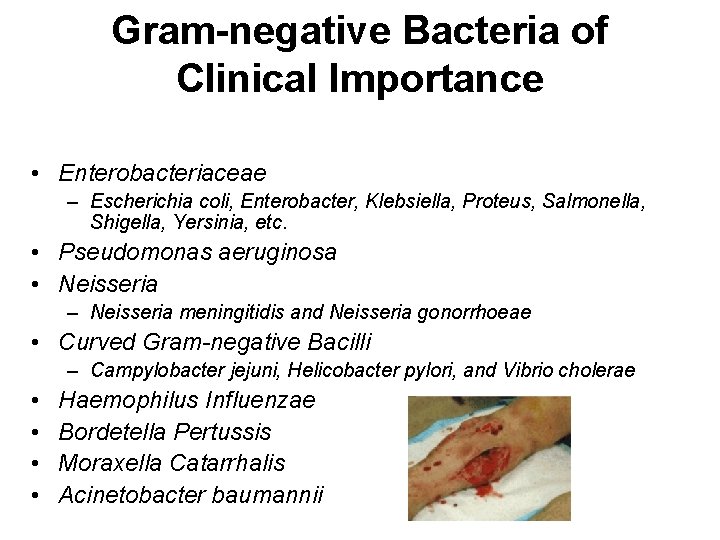 Gram-negative Bacteria of Clinical Importance • Enterobacteriaceae – Escherichia coli, Enterobacter, Klebsiella, Proteus, Salmonella,