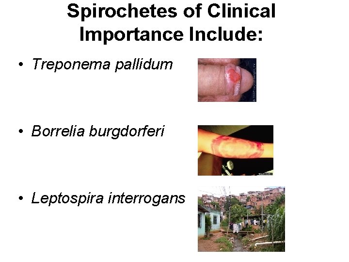 Spirochetes of Clinical Importance Include: • Treponema pallidum • Borrelia burgdorferi • Leptospira interrogans