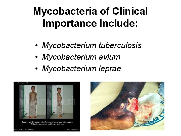 Mycobacteria of Clinical Importance Include: • Mycobacterium tuberculosis • Mycobacterium avium • Mycobacterium leprae