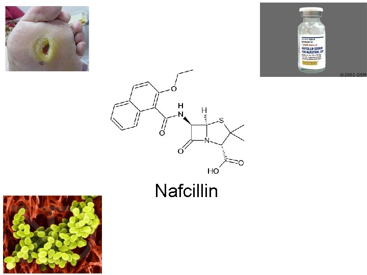 Nafcillin 