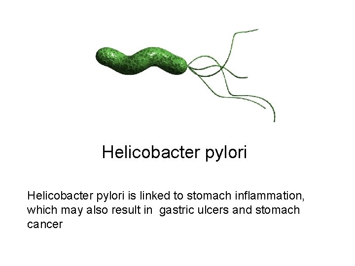 Helicobacter pylori is linked to stomach inflammation, which may also result in gastric ulcers