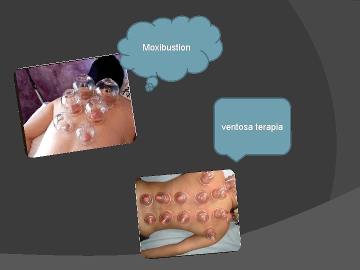 Moxibustion ventosa terapia 