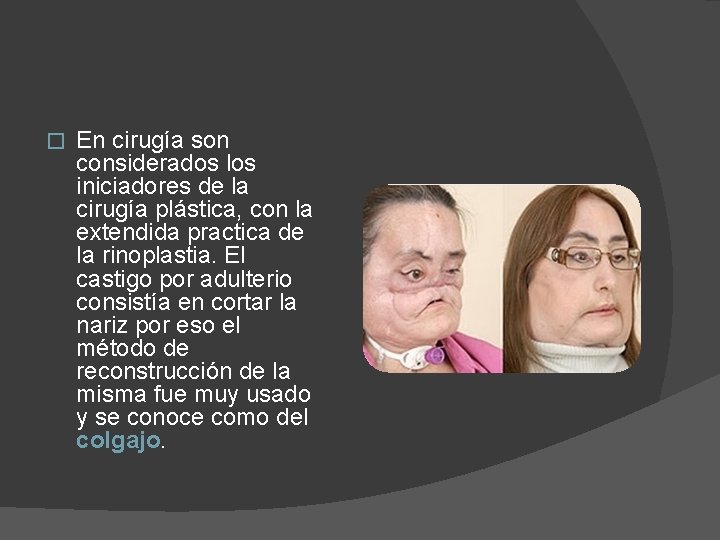 � En cirugía son considerados los iniciadores de la cirugía plástica, con la extendida
