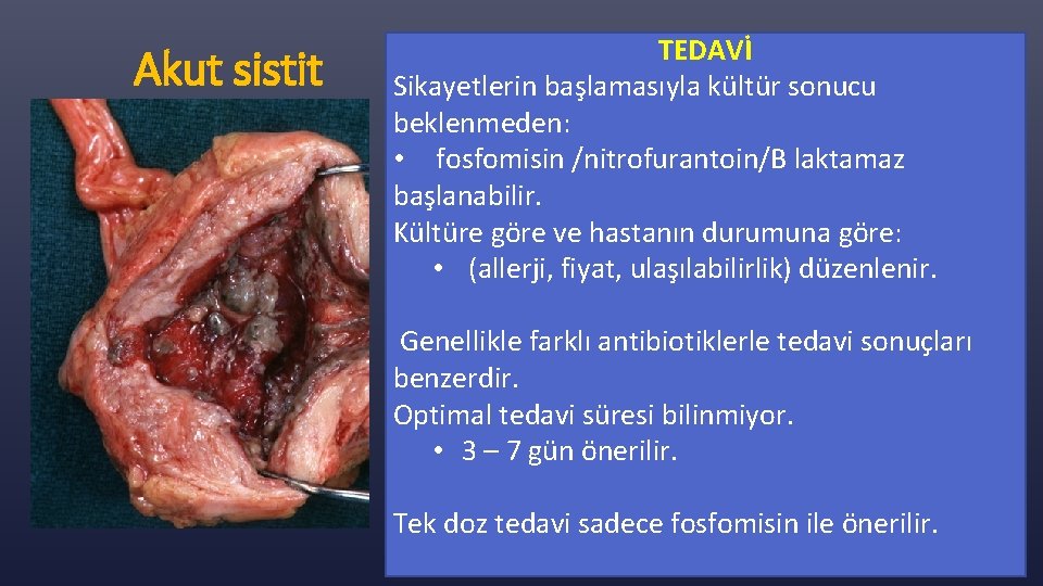 Akut sistit TEDAVİ Sikayetlerin başlamasıyla kültür sonucu beklenmeden: • fosfomisin /nitrofurantoin/B laktamaz başlanabilir. Kültüre