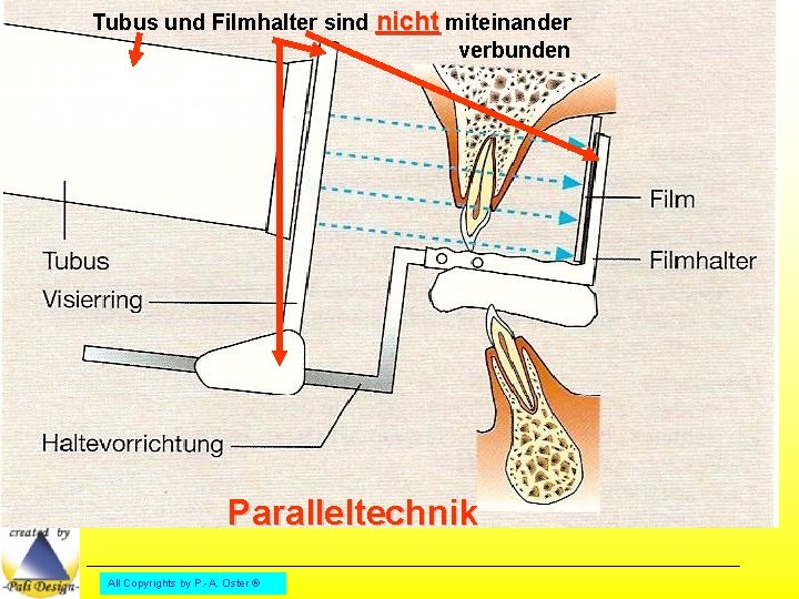 Tubus und Filmhalter sind nicht miteinander verbunden Paralleltechnik All Copyrights by P. -A. Oster