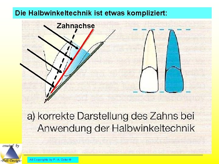 Die Halbwinkeltechnik ist etwas kompliziert: Zahnachse All Copyrights by P. -A. Oster ® 