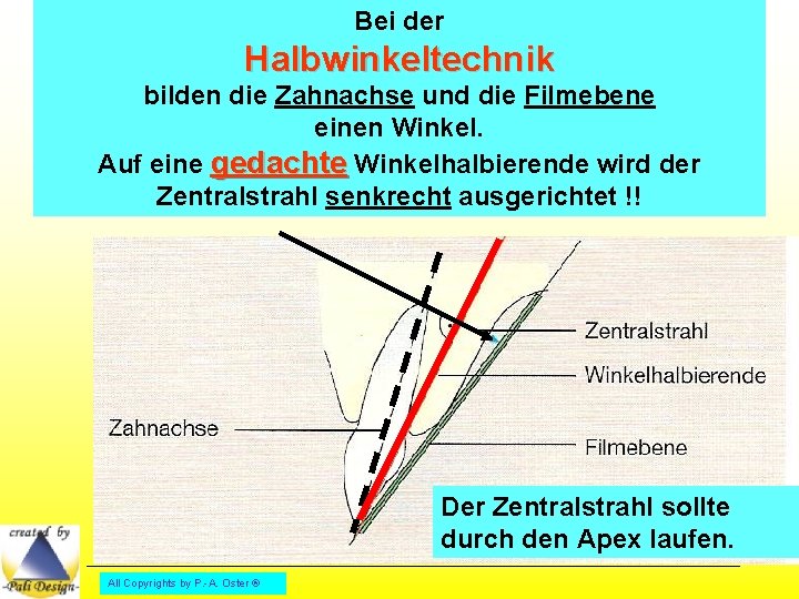 Bei der Halbwinkeltechnik bilden die Zahnachse und die Filmebene einen Winkel. Auf eine gedachte