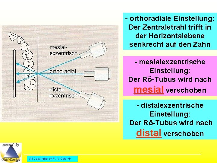 - orthoradiale Einstellung: Der Zentralstrahl trifft in der Horizontalebene senkrecht auf den Zahn -