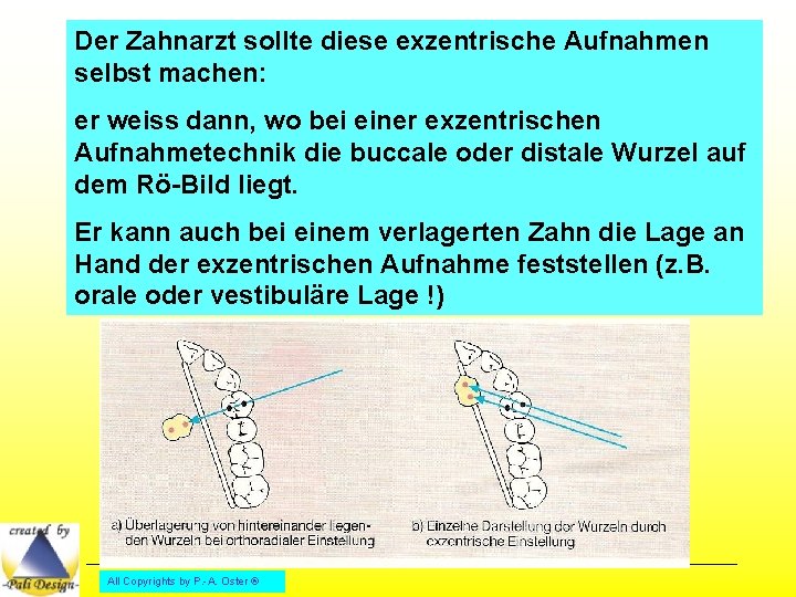 Der Zahnarzt sollte diese exzentrische Aufnahmen selbst machen: er weiss dann, wo bei einer