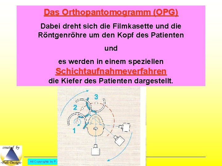 Das Orthopantomogramm (OPG) Dabei dreht sich die Filmkasette und die Röntgenröhre um den Kopf