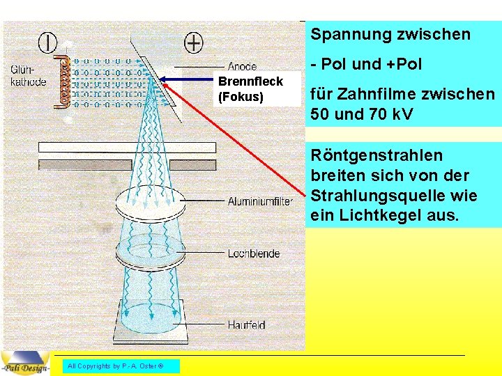 Spannung zwischen - Pol und +Pol Brennfleck (Fokus) für Zahnfilme zwischen 50 und 70