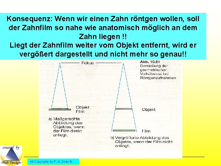 Konsequenz: Wenn wir einen Zahn röntgen wollen, soll der Zahnfilm so nahe wie anatomisch