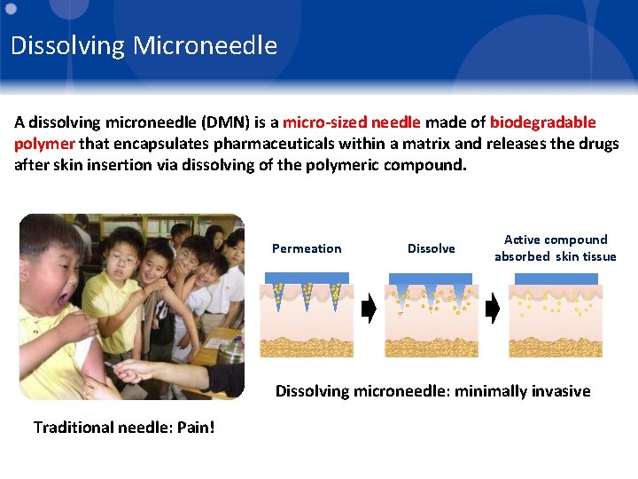 Dissolving Microneedle A dissolving microneedle (DMN) is a micro-sized needle made of biodegradable polymer