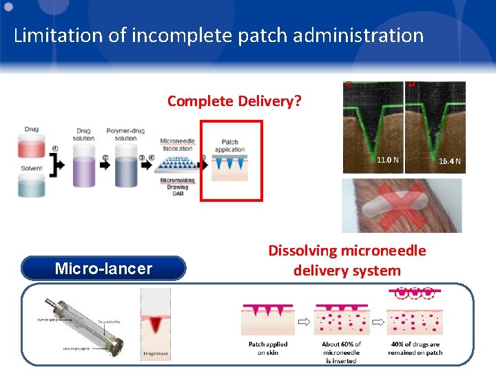 Limitation of incomplete patch administration Complete Delivery? 11. 0 N Micro-lancer Dissolving microneedle delivery