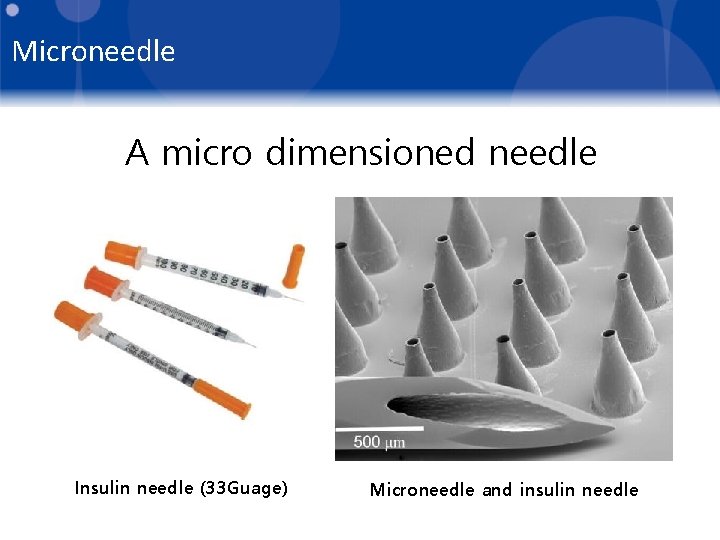 Microneedle A micro dimensioned needle Insulin needle (33 Guage) Microneedle and insulin needle 