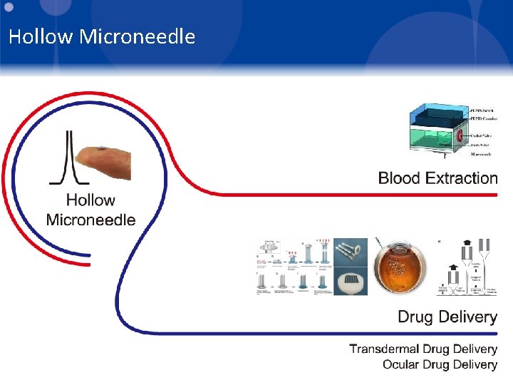 Hollow Microneedle 