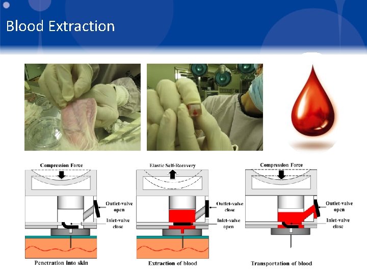Blood Extraction 