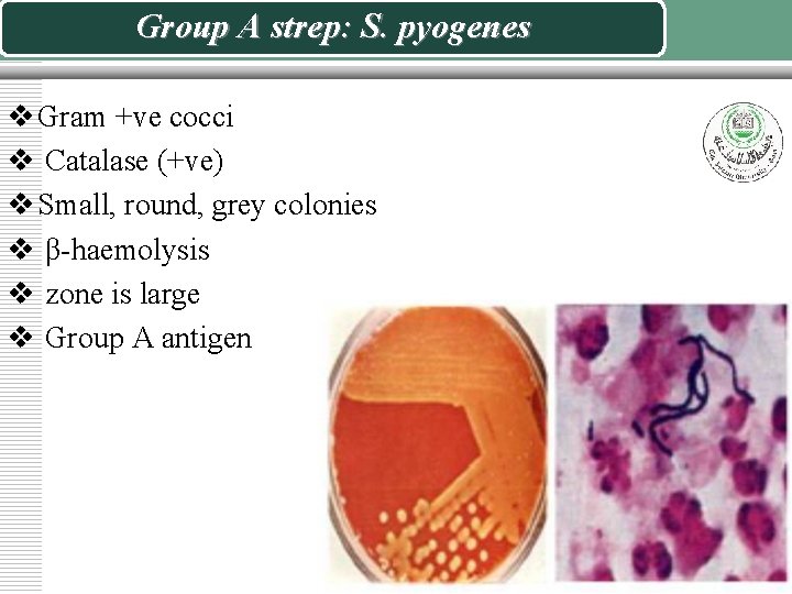 Group A strep: S. pyogenes v Gram +ve cocci v Catalase (+ve) v Small,