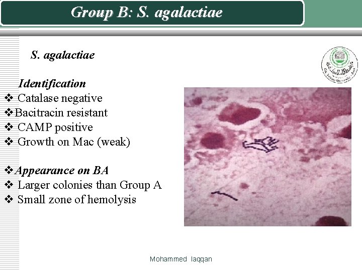 Group B: S. agalactiae Identification v Catalase negative v. Bacitracin resistant v CAMP positive