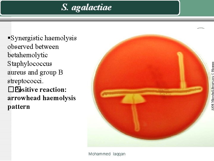 S. agalactiae §Synergistic haemolysis observed between betahemolytic Staphylococcus aureus and group B streptococci. ��