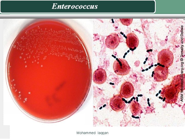 Enterococcus Mohammed laqqan 