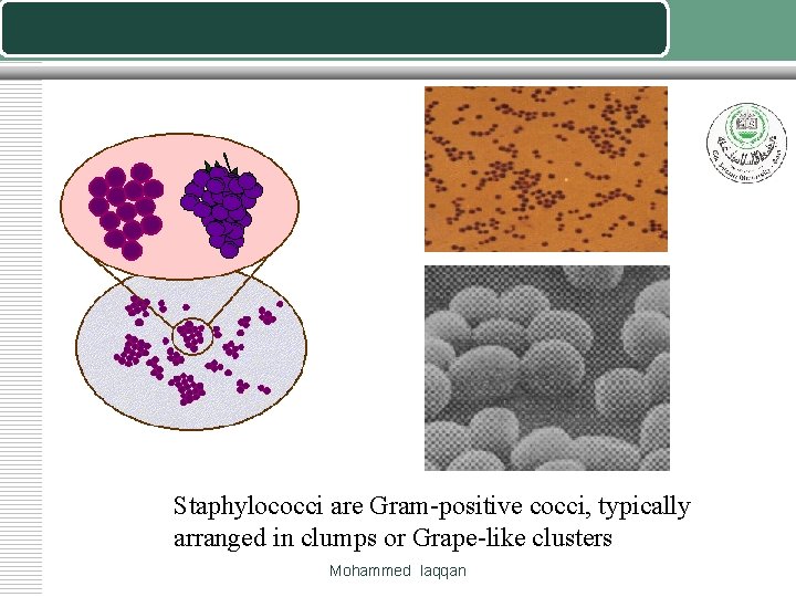 Staphylococci are Gram-positive cocci, typically arranged in clumps or Grape-like clusters Mohammed laqqan 