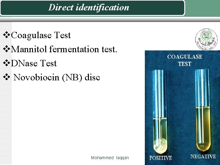 Direct identification v. Coagulase Test v. Mannitol fermentation test. v. DNase Test v Novobiocin