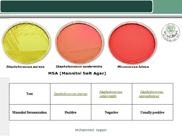 Test Staphylococcus aureus Staphylococcus epidermidis Mannitol fermentation Positive Negative Mohammed laqqan Staphylococcus saprophyticus Usually