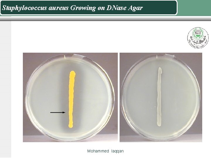 Staphylococcus aureus Growing on DNase Agar Mohammed laqqan 