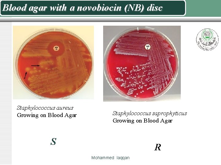 Blood agar with a novobiocin (NB) disc Staphylococcus aureus Growing on Blood Agar Staphylococcus