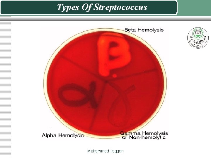 Types Of Streptococcus Mohammed laqqan 