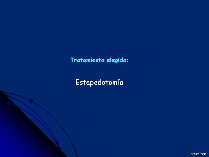 Tratamiento elegido: Estapedotomía Sprekelsen 