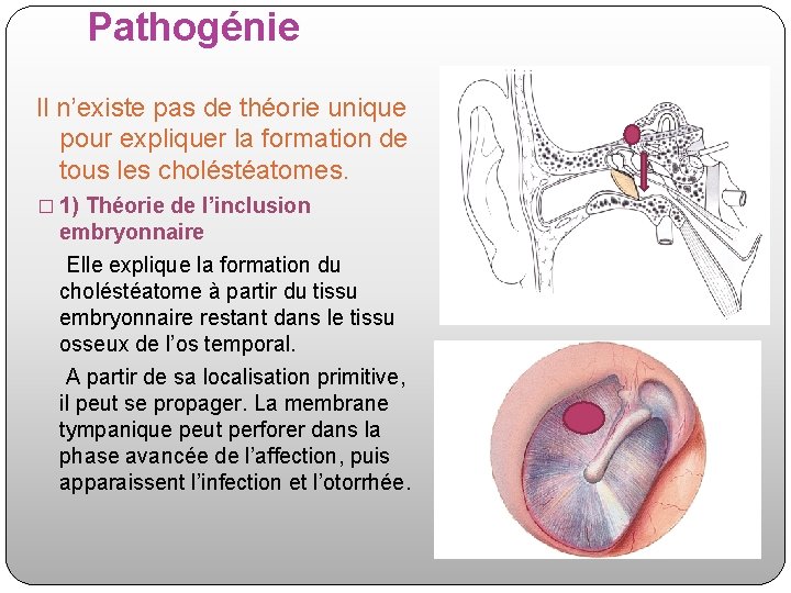 Pathogénie Il n’existe pas de théorie unique pour expliquer la formation de tous les