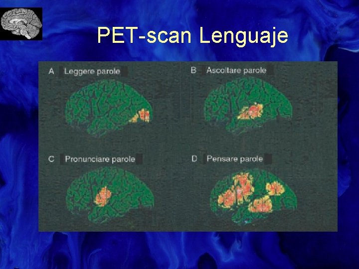 PET-scan Lenguaje 