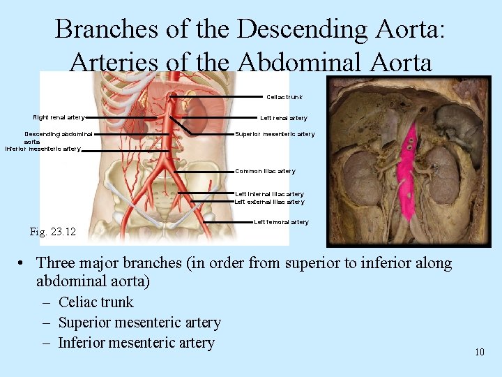 Branches of the Descending Aorta: Arteries of the Abdominal Aorta Celiac trunk Right renal Branches of the Descending Aorta: Arteries of the Abdominal Aorta Celiac trunk Right renal