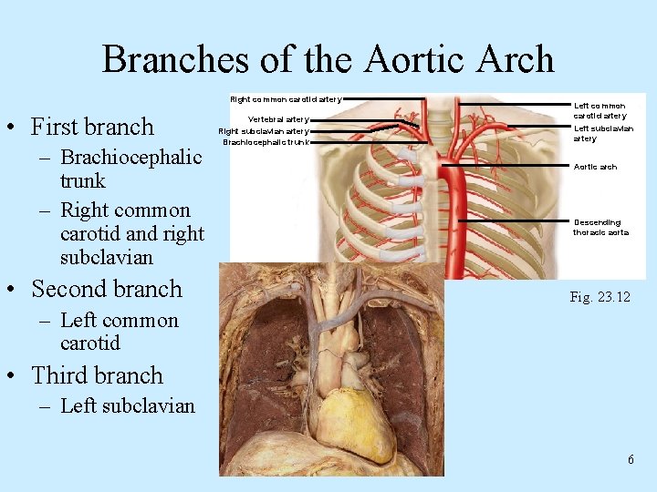 Branches of the Aortic Arch Right common carotid artery • First branch – Brachiocephalic Branches of the Aortic Arch Right common carotid artery • First branch – Brachiocephalic