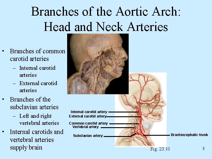 Branches of the Aortic Arch: Head and Neck Arteries • Branches of common carotid Branches of the Aortic Arch: Head and Neck Arteries • Branches of common carotid