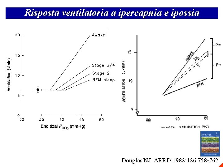 Risposta ventilatoria a ipercapnia e ipossia Douglas NJ ARRD 1982; 126: 758 -762 