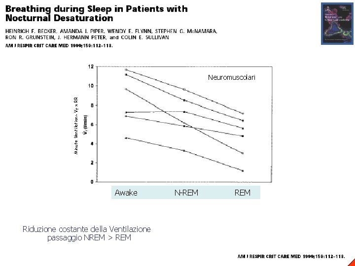 Minute Ventilation= V T x RR Neuromuscolari Awake Riduzione costante della Ventilazione passaggio NREM