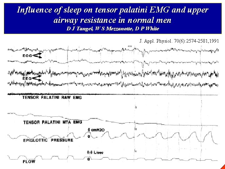 Influence of sleep on tensor palatini EMG and upper airway resistance in normal men