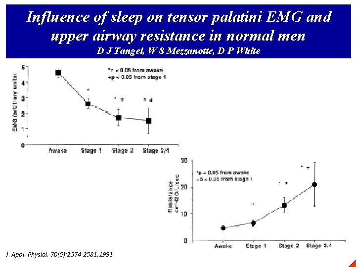 Influence of sleep on tensor palatini EMG and upper airway resistance in normal men