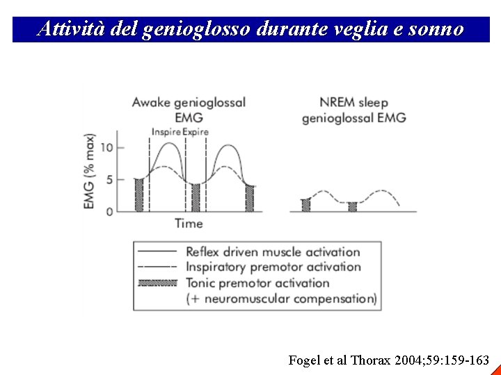 Attività del genioglosso durante veglia e sonno Fogel et al Thorax 2004; 59: 159