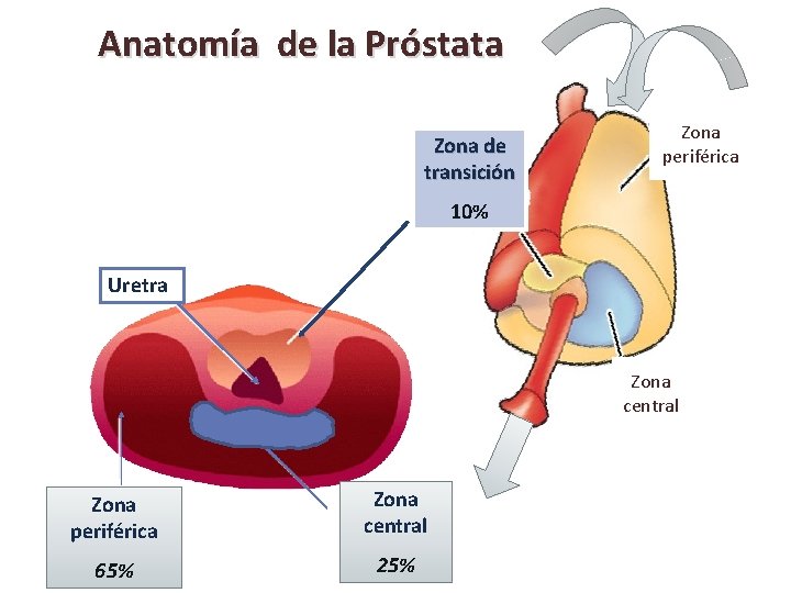 Anatomía de la Próstata Zona de transición Zona periférica 10% Uretra Zona central Zona
