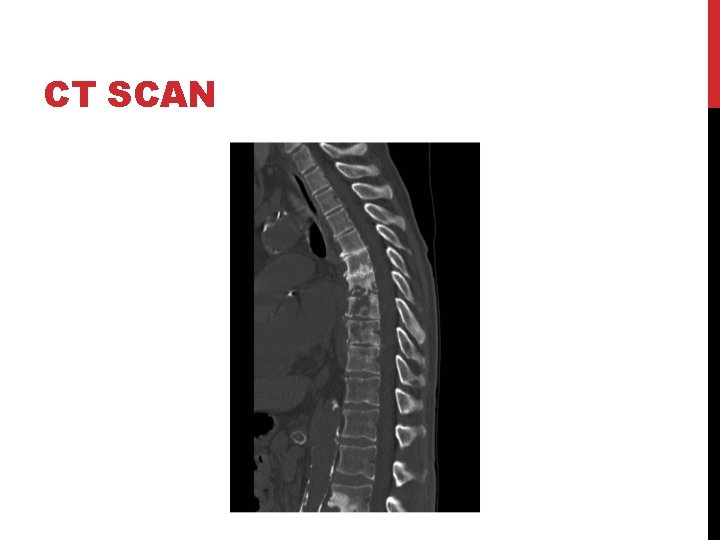 CT SCAN 